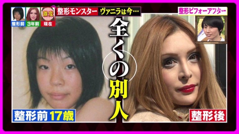 ヴァニラの加工なし画像が顔面崩壊!収入源や仕事は?アレンとの関係は? - エンタメJOKER