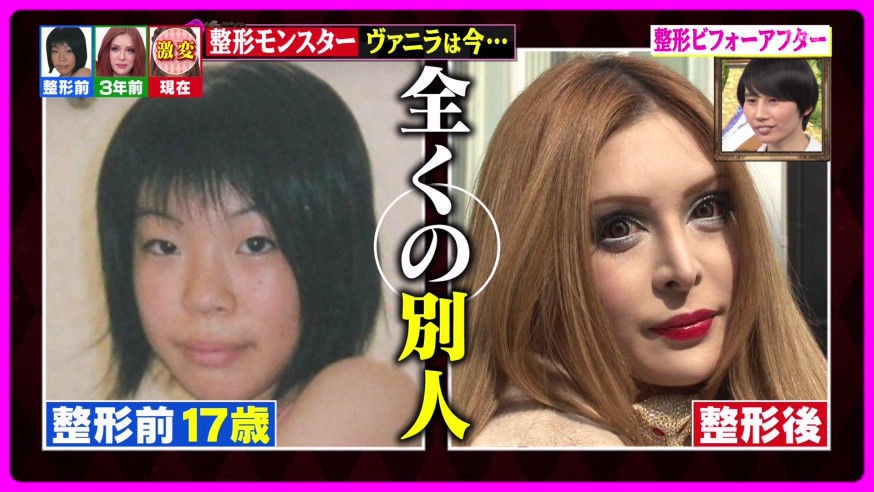 ヴァニラの加工なし画像が顔面崩壊!収入源や仕事は?アレンとの関係は? - エンタメJOKER